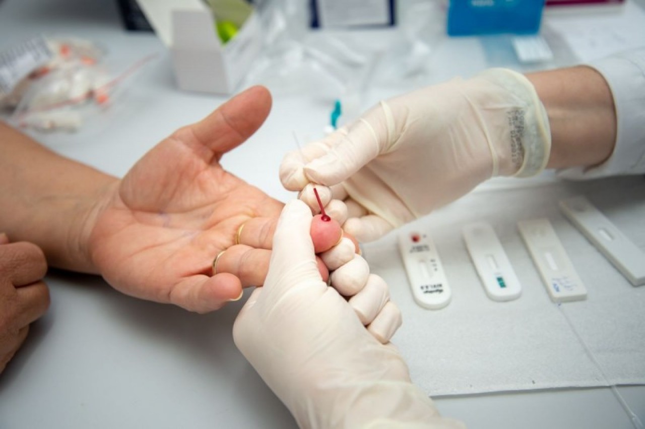 Testes de DST/Aids serão feitos nas unidades de saúde de Guaçuí